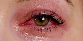 Lash Extensions and Sensitive Eyes: A Journey to Comfortable Beauty